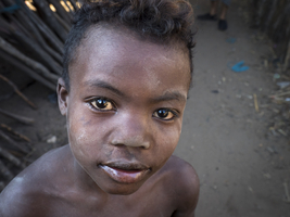 Big-eyed boy looks up sadly questioningly, Ambolomailaka, Madagascar